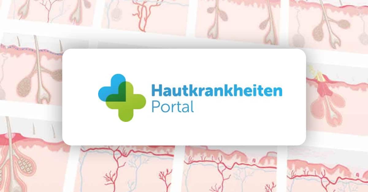 Was Gibt Es Für Hautkrankheiten